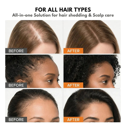 Hair Growth Serum with Built-In Brush | Exosome Scalp Serum for Hair Thickening & Strengthening, Korean Hair Care | 3.38 fl. oz.