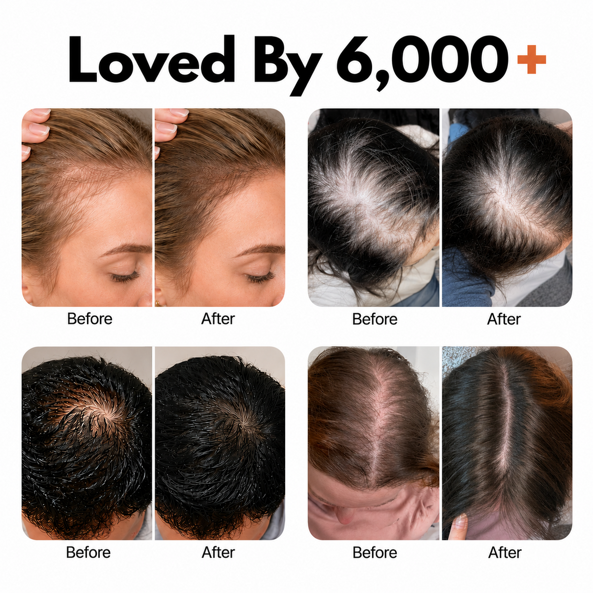 Hair Growth Serum with Built-In Brush | Exosome Scalp Serum for Hair Thickening & Strengthening, Korean Hair Care | 3.38 fl. oz.