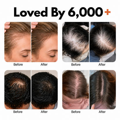 Hair Growth Serum with Built-In Brush | Exosome Scalp Serum for Hair Thickening & Strengthening, Korean Hair Care | 3.38 fl. oz.
